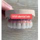 Esthetic Implant Supported Dental Bridge Nickel Beryllium Free