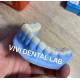 Designed Milled Dental Snap On Teeth For Increasing Vertical Bite