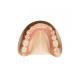 OEM Zirconia Dental Crown Removable Denture Professional Dental Laboratory