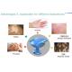 Homeuse 308NM Excimer Light Treatment Treat Vitiligo / Psoriasis