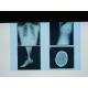 Konida X Ray Medical Imaging Film Waterproof For Agfa Printer