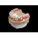 Customized Hpp Frame Acrylic Removable Partial Denture For Missing Teeth