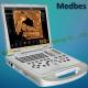 Medical Portable Digital 3D Ultrasound Scanner