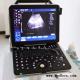 4D Portable Echocardiography Machine 4D Echo Color Digital Portable Ultrasound Machine