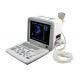 LED Screen Portable Ultrasound Scanner B - Type For Test Pregnant