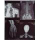 Laser Film for Medical X-ray Image Output Printing