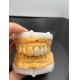 Precision Fit Digital Crowns Implant Dentrues With Compatibility Email Transmission Mode