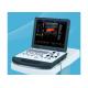 Laptop Portable Ultrasound Equipment , Ultrasound Imaging Machine With 3D Image