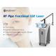 best selling acne scar removal / Gynecology treatment 10600nm wavelength USA joints laser CO2 fractoinal laser machine