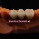 High Esthetics Zirconia Crown The Ideal Restoration for Dental Bridges China Dental Lab