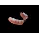 Affordable Custom Removable Denture Easy Maintenance for Missing Teeth