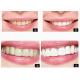 Private Logo Personal Care Products Tooth Bleaching System For Home Teeth Whitening