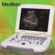 Professional Ultrasound Imaging System 15 Inch LED Laptop Hospital Machine