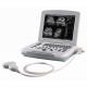 B/W laptop ultrasound machine
