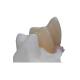 Removable Pure Titanium Dental Implant Bar Custom Abutment