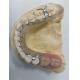 Replace Missing Teeth Removable Partial Denture Dental Prosthesis Flexible Design