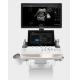 Artificial Intelligence Based SonoScape Ultrasound Machine Trolley P60 Exp
