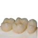 High Strength Zirconia Ceramic Teeth Precision Digitally Manufactured