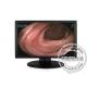High Definition SMPTE296M Medical LCD Monitor Display SDI embedded audio
