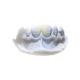 Efficient Resin Removable PFM Dental Crown Health Materials