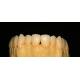 Dental Lab Fixed Prosthetics Layered Zirconia Dental Crown For Front Teeth