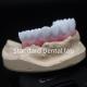 High Esthetics White Dental Crown Diagnostic Wax Up Customized