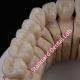 Digital CAD CAM Dental Lab PFZ Crowns Translucent Layered Zirconia Crown
