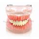 Dental Transparent gingivitis model pathology oral model dental calculus with metal jaw frame new
