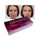 Ultra3 Juvederm Hyaluronic Acid Dermal Filler 20mg/Ml Lip Enhancement Fillers