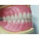 Ivoclar Teeth Full Acrylic Denture Prosthesis Easy To Clean High Durability