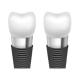 Enhancing Oral Aesthetics With Dental Implant Bars