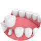 Beautiful Dental Crowns And Bridges Smooth Surface For Oral Hygiene Safety