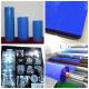 Durable Blue Radiograph Film 11x14 For Accurate Medical Diagnosis