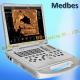 Canyearn A75 Full Digital B/W Portable Ultrasonic Diagnostic Ultrasound System