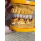 Full Jaw Dental Implant Crown Metal Printed Digital Tooth Supported Bridge