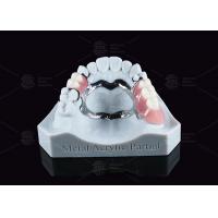 Removable Metal Acrylic Partial Denture With Clasps For Partial Chewing