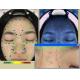Cosmetics Using 3D Wrinkle Analysis Machine RGB + UV + PL 3 Spectrums