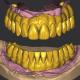 3 Shape Dental Crown Design / Exocad Implant Design ISO Approved
