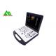 High Accuracy Laptop Ultrasound Scan Machine With Lithium Battery For Human Use