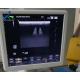 Aloka Hivision Ascendus Report Error Ultrasound Machine Repair Replace Cell Board