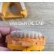 Full Jaw Dental Zirconia Bridge Implant Crown Translucency Esthetic