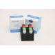 Fluorescent Real Time HCV RT PCR Kit HSV2 Test Kit Laboratory Use CE