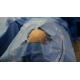 SMMS Sterile Fenestrated Drape for Brain Surgery CE ISO13485 Certificate