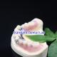 Acrylic Metal Partial Denture Frameworks High Esthetics SDL dental lab