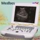 Portable 3D Black White Ultrasound Scanner Machine with Great Price