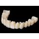 High Esthetics Full Contour Zirconia Crown Implant CAD CAM FCZ