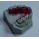 Orthodontic Retainer Expander Comfortable And Affordable Solution