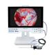 Medical medical full HD endoscope camera with LCD medical monitor Endoscopic Camera Video Endoscope System with 80W Ligh