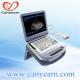 cheapest small size cpu 3D/4D laptop ultrasound machine in China