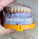 Alloy Dental Implant Supported Crowns Implants And Bridges Digital